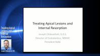 Treating Apical Lesions and Internal Resorption Webinar Thumbnail