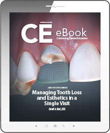 Managing Tooth Loss and Esthetics in a Single Visit eBook Thumbnail