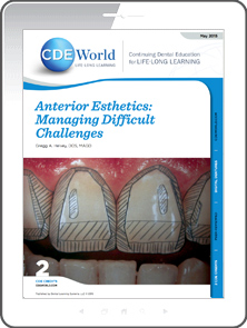 Anterior Esthetics: Managing Difficult Challenges eBook Thumbnail
