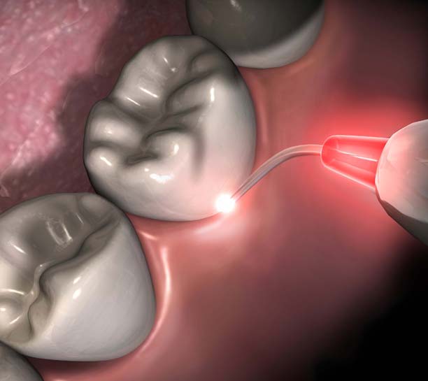 Electrosurgery in the Esthetic/Restorative Practice: Everyday Procedures That Help Create Excellence in Dentistry eBook Thumbnail