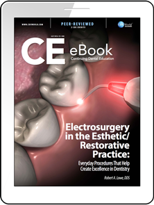 Electrosurgery in the Esthetic/Restorative Practice: Everyday Procedures That Help Create Excellence in Dentistry eBook Thumbnail