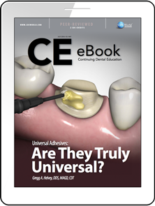 Universal Adhesives: Are They Truly Universal? eBook Thumbnail