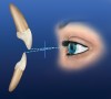 Figure 9  Diagram of a simulated observer’s perspective on the maxillary and mandibular anterior teeth.