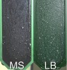 Figure 3  A CRT test result from a high-risk patient (MS = mutans streptococci; LB = lactobacilli).