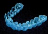 Figure 7  Proper adaptation and trimming of a whitening tray on a maxillary cast. Tray showing both the buccal and lingual aspects scalloped.