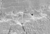 Figure 4  Gap junction at CEJ where enamel (black arrows) and cementum (white arrows) do not meet, which, in turn, exposes an area of dentin (between arrows). Large pore-like structures in dentin are exposed dentinal tubules. Note the irregular contours and rough surface texture. Bar = 100 µm at an original magnification of 300x.