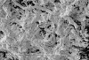 Figure 7  High-magnification view from Figure 6 of dental calculus exhibiting the typical surface layer of microbes embedded in a mineralizing matrix. Bar = 5 µm at an original magnification of 5,000x.