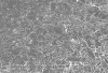 Figure 3  Scanning electron micrograph of the microstructure of a feldspathic veneer porcelain. Acid etching removes the glass and reveals the leucite crystals.