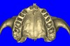 Figure 12b  (A) By sectioning the 3D model, virtual implant placement was assessed for the necessary 2 mm of facial and palatal bone surrounding the implant, and (B) by using segmentation techniques to remove the existing teeth, leaving the sockets, the alveolar complex was appreciated fully.