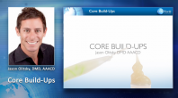 Core Build-Ups Webinar Thumbnail