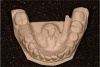 Fig 7. Postoperative stereolithographic model of restoration.