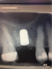 Fig 19. Postoperative radiograph.