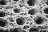 This SEM is basically the same as Fig 2 except the collagen seen in Fig 2 has been removed with collagenase enzymes exposing the dentin underneath that has not been, or has been minimally, demineralized by acidic pretreatment. It is this interface that is important to engage, via hybrid layer formation, to achieve good bonding and a well-sealed interface. (SEM courtesy of the late Dr. John Gwinnett.)