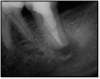 Fig 20. Postoperative radiograph.