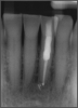 Fig 23. Postoperative radiograph.