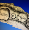 Fig 2. Scan of the abutment.
