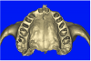 Figure 12b  (A) By sectioning the 3D model, virtual implant placement was assessed for the necessary 2 mm of facial and palatal bone surrounding the implant, and (B) by using segmentation techniques to remove the existing teeth, leaving the sockets, the alveolar complex was appreciated fully.