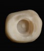 Fig 6.  An elevated portion (nipple) inside the crown remains after the milling process, which indicates the location of the abutment screw.