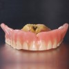 (8.) Denture demonstrating poor oral hygiene.