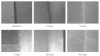 (2.) Illustration of progressive closure of artificial marginal gaps between a bioactive cement (ie, calcium aluminate/glass ionomer) and a segment of dentin.