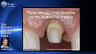 Tissue Management Overview for the Restorative Practice Webinar Thumbnail