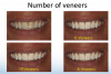 Fig 3. Altered frontal view images showing treatment variations.