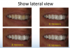 Fig 4. Altered lateral view images showing treatment variations.