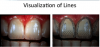 Fig 6. Visualization of lines used to assess mock-ups.