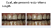 Fig 7. Evaluation of the existing restoration length.