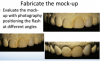 Fig 11. Mock-up fabricated and evaluated with photography, positioning the flash at different angles.