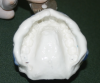 Figure 1: Example of an alginate impression.