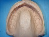 Figure 1  The impression with all anatomical features is captured.