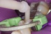 Figure 8  Snap-on, right-angle application tip allows for inside-out filling of the proximal box.