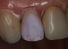 Figure 15  The ìstain within the linesî staining technique confined the appropriate stain within the desired location.