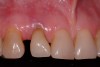 Figure 1  Pretreatment clinical view.