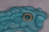 Figure 9: The natural tooth shell hollowed out and placed into the pre-surgical index.