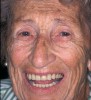Figure 9  The patient experienced a return to comfort and confidence that also resulted in an improved quality of life.