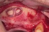 Figure 24  Then, the septum was isolated.