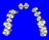 Figure 8a  By using the masking feature, the inner and outer layers of bone were removed virtually, revealing (A) the enamel and root structure of the teeth and the rotated position of the right central and (B) a slight mesial dilacerations of the root apex.