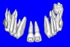 Figure 8b  By using the masking feature, the inner and outer layers of bone were removed virtually, revealing (A) the enamel and root structure of the teeth and the rotated position of the right central and (B) a slight mesial dilacerations of the root apex.